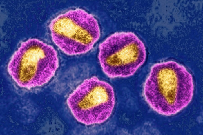 Biến thể HIV mới được phát hiện làm tăng số lượng các phần tử virus HIV