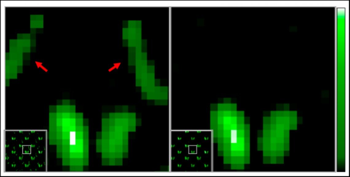 Dùng kỹ thuật quan sát thiên văn học để quan sát hình ảnh y khoa