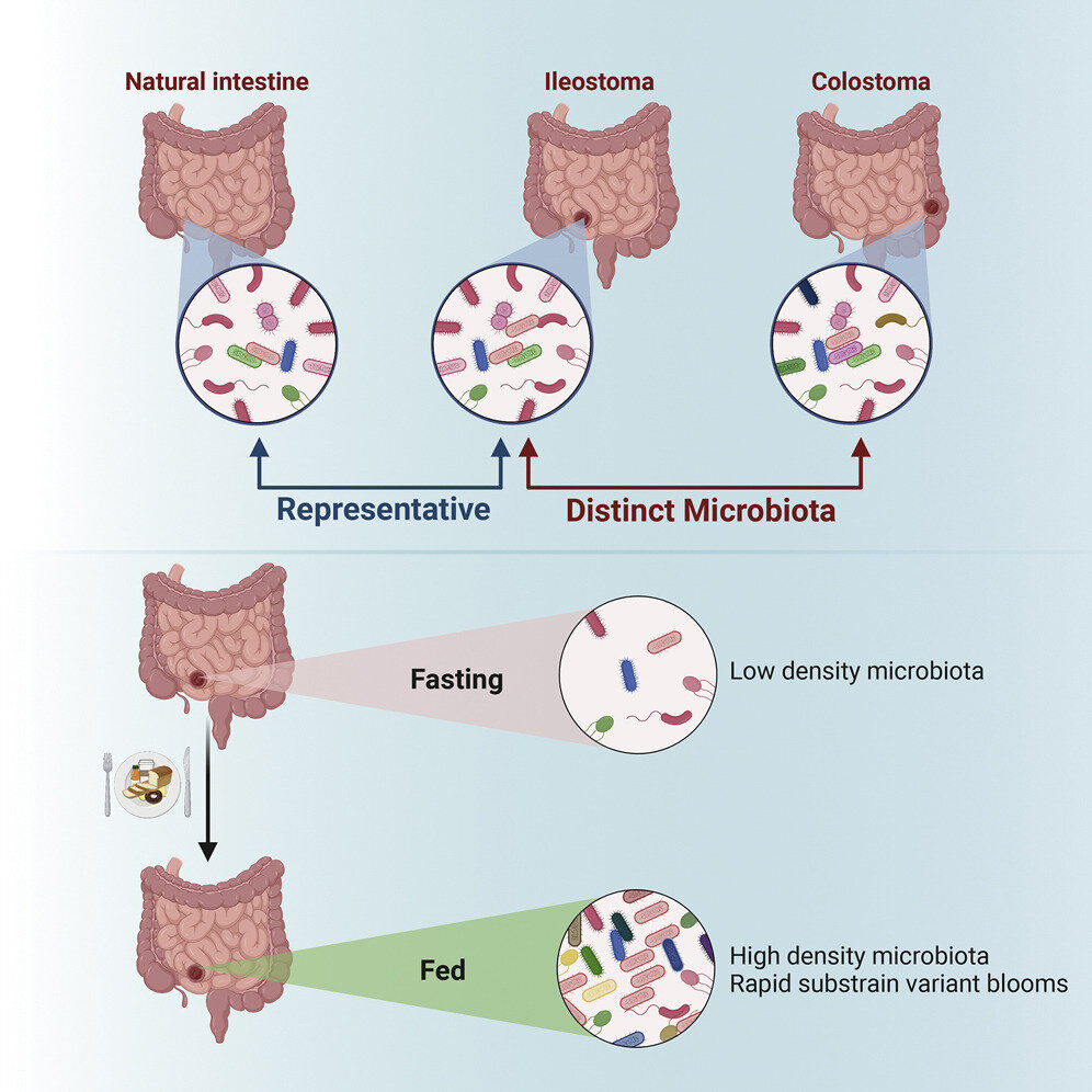 Bước tiến mới trong nghiên cứu về các bệnh đường ruột