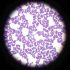 Staphylococcus-aureus-under-microscope-Adapted-from-Foster-2017