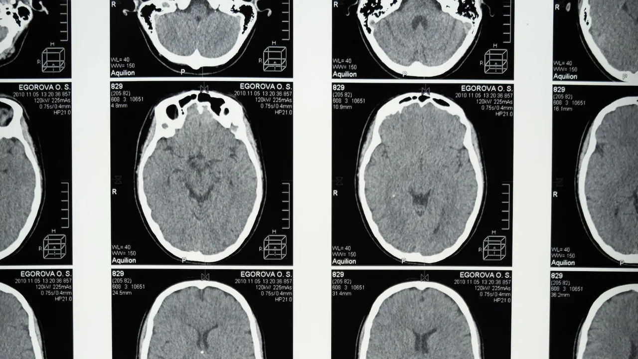 Đảo ngược tín hiệu não sai hướng để điều trị trầm cảm