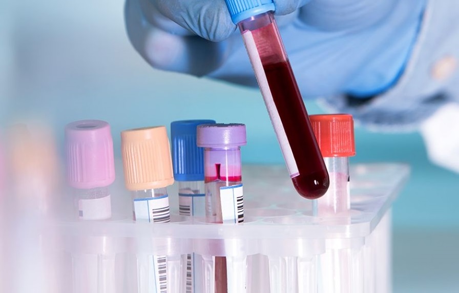 Nhờ máy học, một xét nghiệm máu mới có thể dò sớm nhiều bệnh ung thư