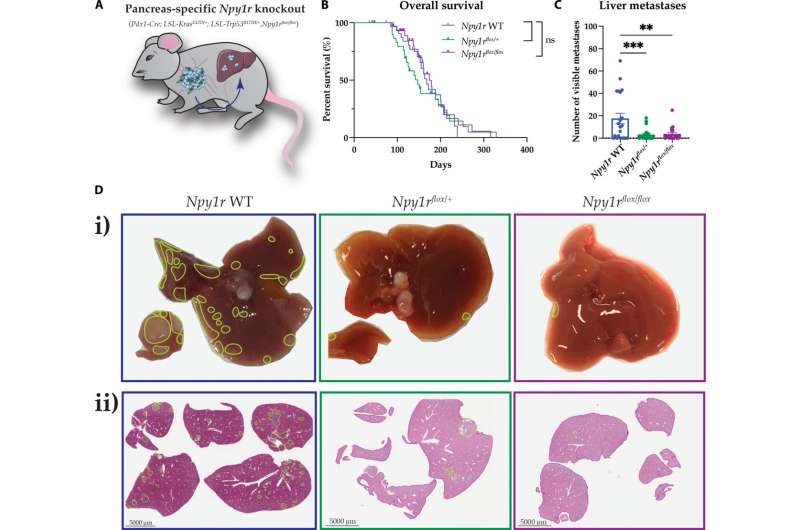 Nghiên cứu mới giúp ngăn chặn ung thư tuyến tụy di căn