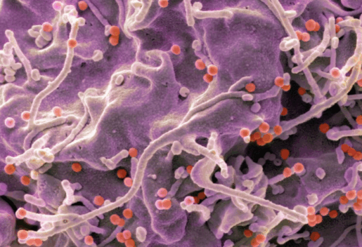 Vắc-xin mRNA phòng HIV tạo phản ứng miễn dịch mạnh ở người Vắc-xin mRNA phòng HIV tạo phản ứng miễn dịch mạnh ở người