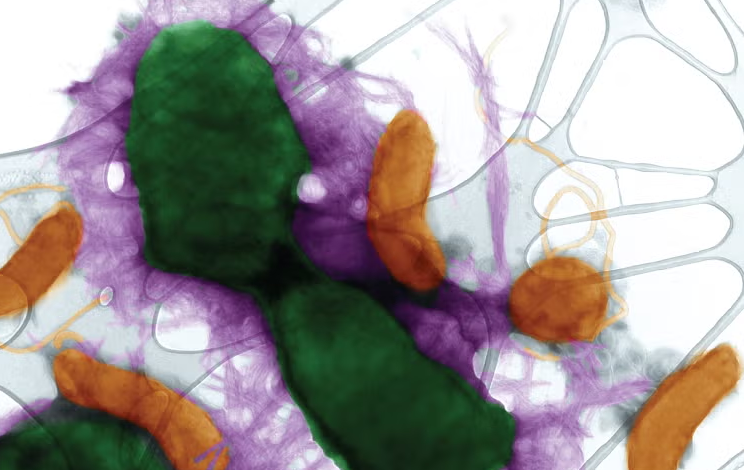 Vi khuẩn biến protein gây bệnh Alzheimer thành áo giáp bảo vệ 